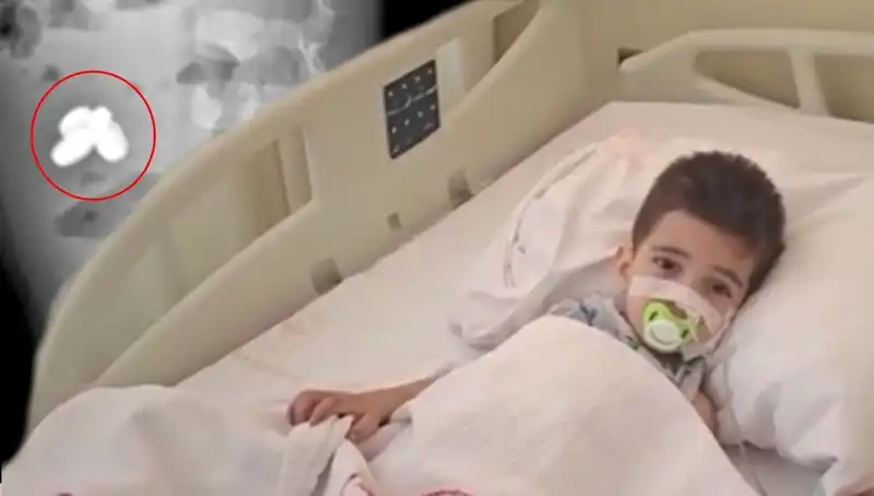 Hayat Kurtaran Müdahale: Pil ve Mıknatıs Yutan Çocuğun Dramı