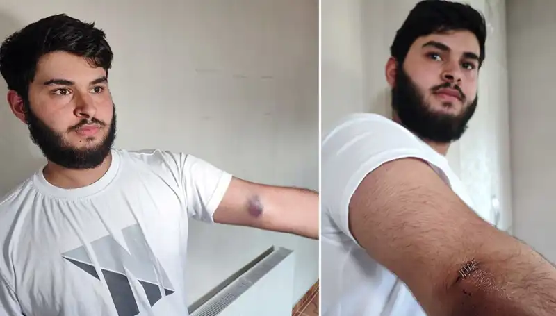 Bahçeye Kaçan Top Mahallede Gerginlik Yarattı: Conoların Kamyoneti Ortalığı Karamelledi